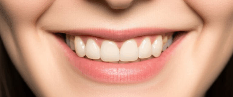 Can Veneers Change Your Face Shape Understanding the Subtle Indirect Effects on Facial Aesthetics