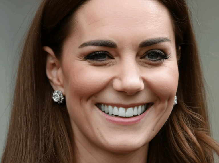 Did Kate Middleton Get Veneers Decoding the Duchess s Famous Smile