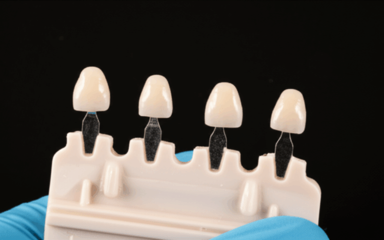 What Are Zirconia Veneers My Personal Guide to This Durable Cosmetic Solution